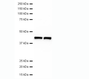 植物抗β-Actin单克隆抗体 MAN1011-100ul